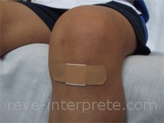 reve de contusion - interpretation des reves